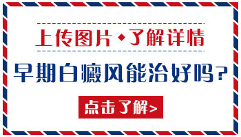 孩子得了白癜风能治好吗