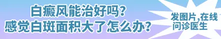 春天得了白癜风一定会扩散吗