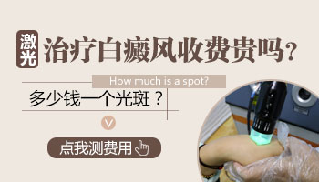 白斑照激光贵吗 大概一周照几次
