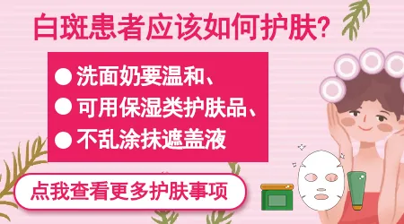 面部白癜风患者适合用什么牌子的护肤品