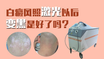 白癜风照光边缘皮肤变黑