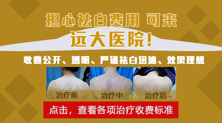308准激光治疗白癜风白斑一次费用