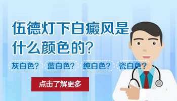 伍德灯检查白斑是白色的是不是白癜风