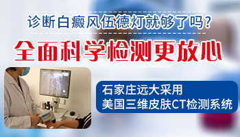 伍德灯检查白斑会误诊吗
