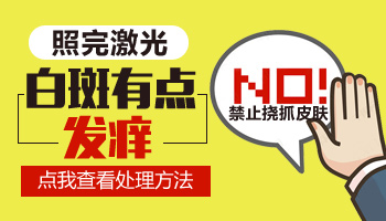 白癜风照UVB紫外线灯后很痒为什么