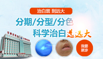 小孩长白癜风怎么治