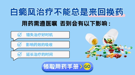 初期白癜风白斑图