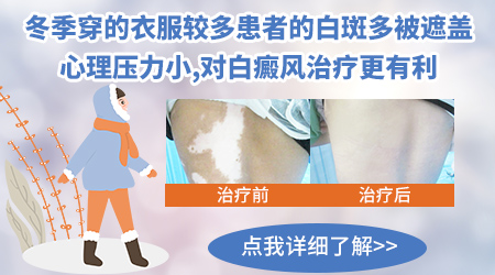 为什么冬天白癜风看起来变小了