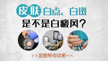 伍德灯检查白斑对宝宝有影响吗