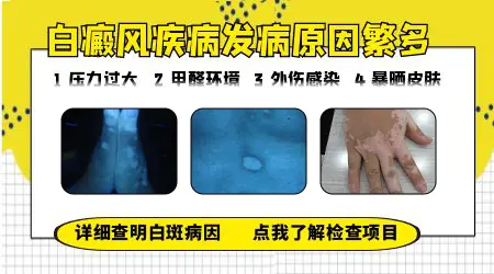 为什么突然会得白癜风 常见诱因有哪些