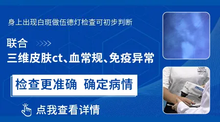 白斑表面光滑无皮屑就肯定是白癜风吗