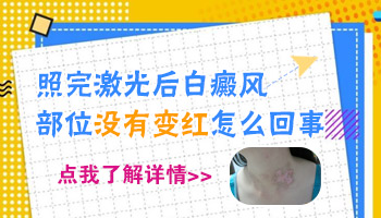 做了两次激光308白斑变红了