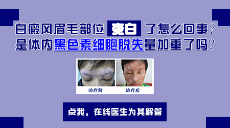 右边的眉毛变白了皮肤也白一块