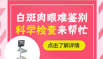 局限性白癜风图片