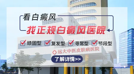 皮肤上有白斑去石家庄哪家医院看好