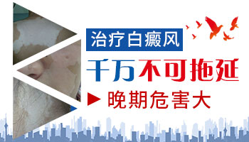 瓷白色的白斑是不是白癜风怎么判断