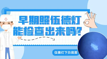 白斑做伍德灯检查显示亮白色是什么意思