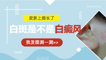 脸部中间有指甲盖大小的白块