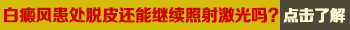 白癜风为什么用紫外线光疗仪照光后脱皮