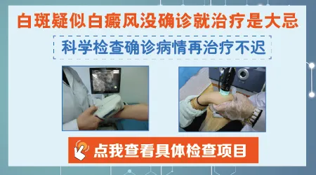 眼睛下面有白色斑点怎么看是不是白癜风