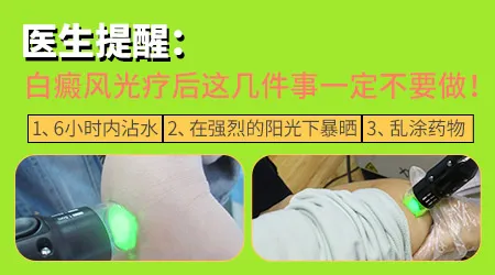 白癜风光疗后出现水疱是正常现象吗