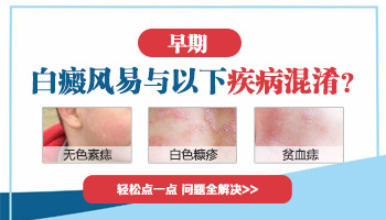 白癜风白斑的早期症状是什么