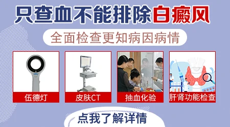 过敏会引起白癜风发病吗？