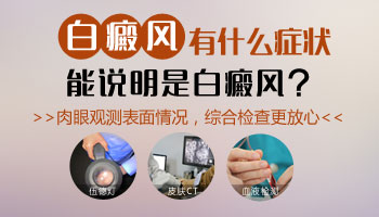 宝宝脸上的白点不确定是不是白癜风怎么看