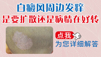白癜风好转时发红发痒的图片