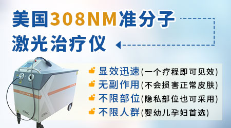 白癜风照激光副作用是什么