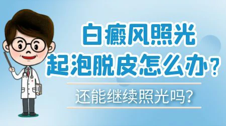 白癜风照光后白斑部位起了脓疱要去医院吗