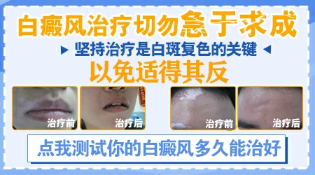 皮肤上出现白斑去石家庄哪个医院治好