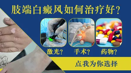 四肢末端的白癜风哪种治疗方法更有效