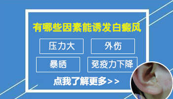 女性长了白癜风和什么因素有关系