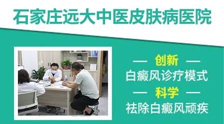 白癜风的民间偏方可以相信吗