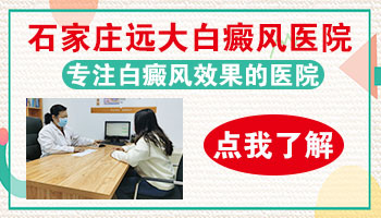 白癜风患者不必谈白色变