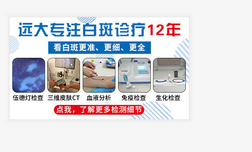 普通白斑图片 白癜风的图片对比