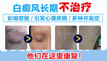 脸部白斑汗毛也是白的什么情况