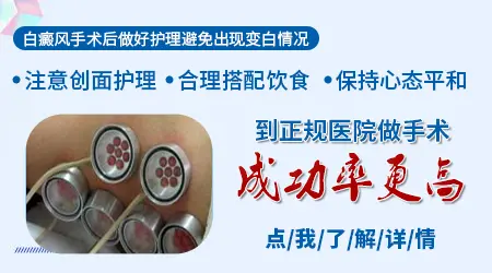 表皮移植治疗白癜风成功率高吗