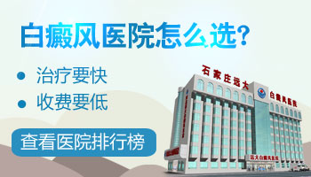 廊坊白癜风医院如何治疗儿童白斑