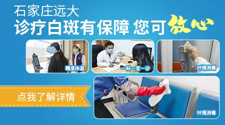 有中医治疗白癜风的偏方吗