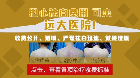 石家庄远大看白斑能用医保吗