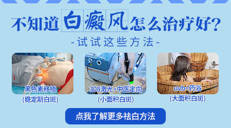 河北去哪里看白癜风 石家庄专治白斑病医院