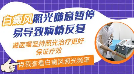 白癜风光疗好后复发的概率多少