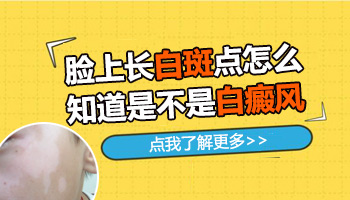 缺维生素脸上白斑和白癜风区别