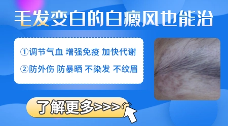 儿童身上的白斑毛发也变白了怎么办