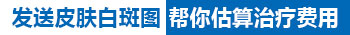 白癜风的治疗费用大概一个月多少钱