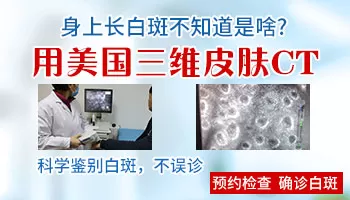 初期眉毛白斑图