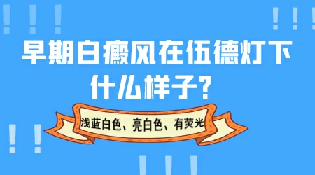 伍德灯检查白斑结果是亮白色一定是白癜风吗