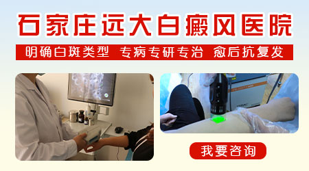 白癜风如果全身都治好了还用抗复发吗